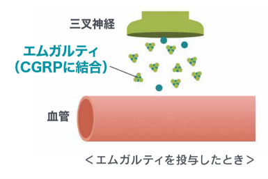 エムガルティ、アジョビ投与時